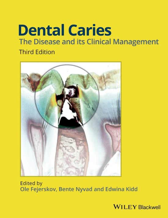 samenvatting dental caries, meerdere hoofdstukken 